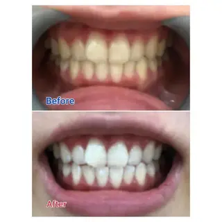 M渋谷店所属・M渋谷 ホワイトニングのエステ・リラクイメージ