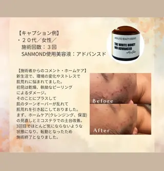 Moana【モアナ】 HIROのエステ・リラクイメージ