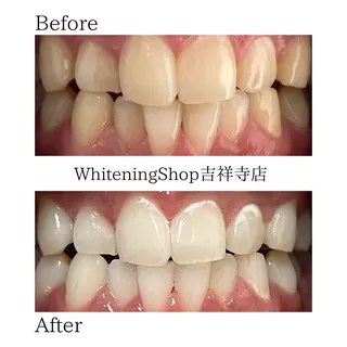 ホワイトニング ショップ吉祥寺店のエステ・リラクイメージ