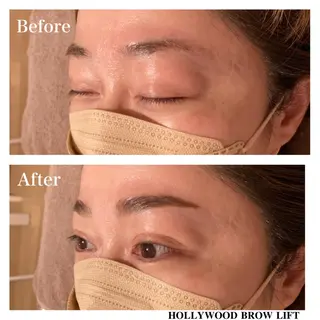 アイブロウ Ｂ&H所属・頭痛•肩こり専門/ 眉サロンB&H心斎橋のエステ・リラクイメージ