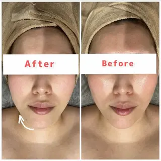 ハーブピーリング専門 muro.のエステ・リラクイメージ