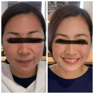 メンズ 大阪脱毛|ちぇるま| 眉毛Wax｜美肌管理のエステ・リラクイメージ