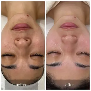 すっぴんたまご肌 平木さやかのエステ・リラクイメージ