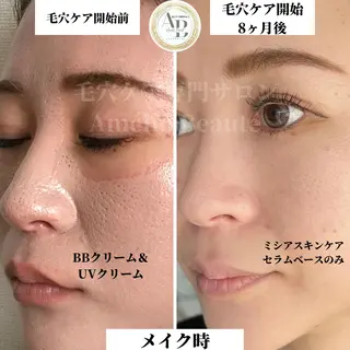 毛穴ケア専門サロン Amélio Beauté所属・毛穴ケア専門サロン アメリオボーテのその他イメージ