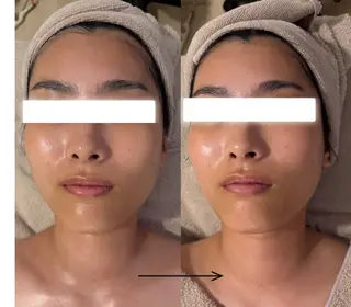 POLA THE BEAUTY 天王寺店所属・UEDA | POLA 天王寺のエステ・リラクイメージ