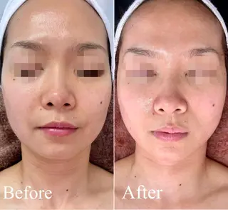 アイラッシュ＆フェイシャルサロン　ベアトリーチェ所属・医療提携美容サロン Beatriceのエステ・リラクイメージ