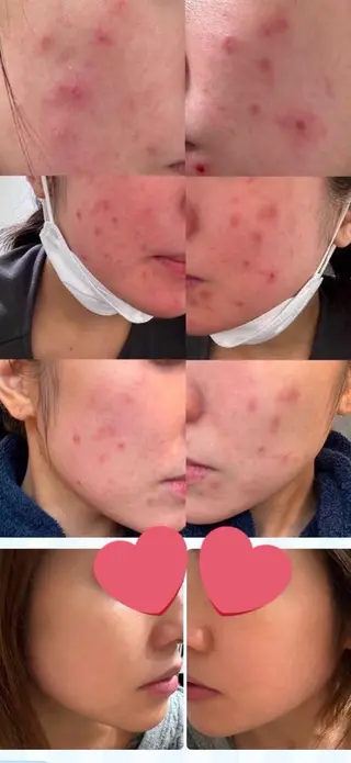 CEサロンbelle mona所属・CEサロン belle monaのエステ・リラクイメージ