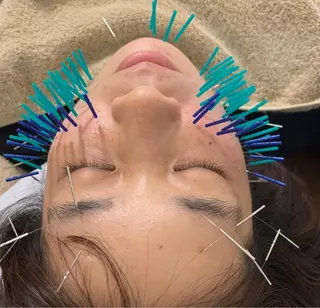 表参道鍼灸院K 美容鍼🔮ララピールのエステ・リラクイメージ