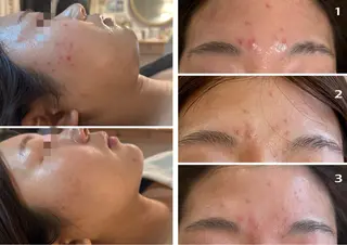 NICORI　小顔&肌質改善専門店所属・小顔＆肌質改善 NICORIのエステ・リラクイメージ