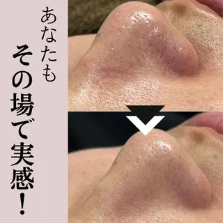 毛穴専門店Bébé 大阪中央店のエステ・リラクイメージ