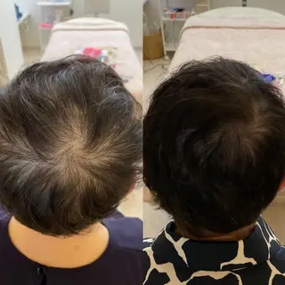 Blooming所属・LOUISE. ／肌質・頭皮のエステ・リラクイメージ