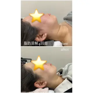 毛穴洗浄・痩身・脱毛 /アルカンジュのエステ・リラクイメージ