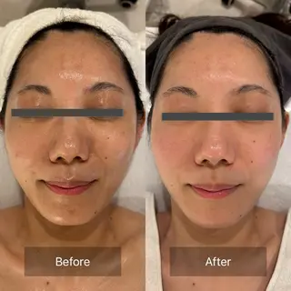 mine.mマインエム所属・mine.mi マインエムのエステ・リラクイメージ