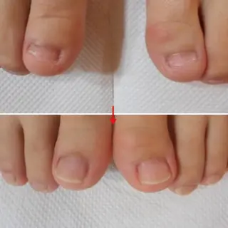 ネイル ネイルサロンアリューム所属・ネイルサロン アリュームのネイルデザイン