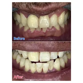 メンズ MBEAUTYSALON 千葉店・京成大久保所属・Melty 輝のその他イメージ