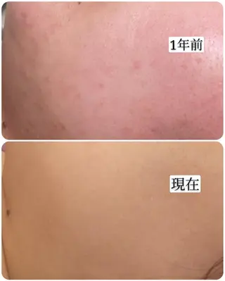 🅖🅤🅩🅔🅛 salonのエステ・リラクイメージ