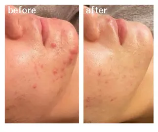 aimee　肌質改善サロン【アイミー】所属・肌質改善サロン aimee｜アイミーのエステ・リラクイメージ