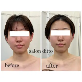 salon ditto所属・mio (小顔・ヘッドスパ)のエステ・リラクイメージ