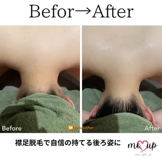 Meupニキビ専門店 背中/ハーブ/肌管理のその他イメージ