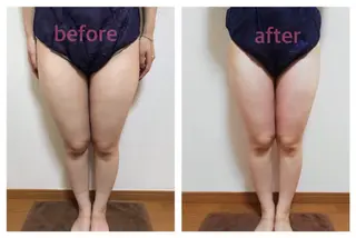 biloop所属・《痩身×疲労改善》 BILOOPのエステ・リラクイメージ