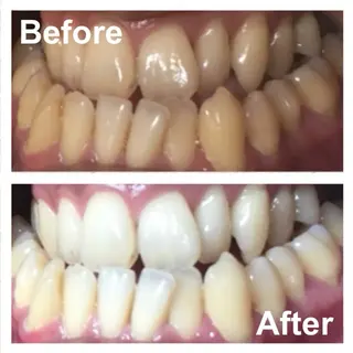 KalanDiva〜 ｶﾗﾝﾃﾞｨｰﾊﾞ〜のエステ・リラクイメージ