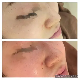 ミディアム カラー パーマ ヘアアレンジ メンズ キッズ ネイル マツエク・マツパ アイブロウ ニキビ特化型エステ 🍓最短で肌質改善のエステ・リラクイメージ