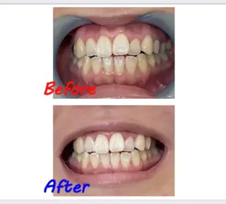 セルフホワイトニングサロン　ラヴィアン所属・ホワイトニングサロン La vie enのその他イメージ