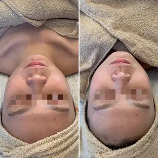 La beauté et santé岡崎店所属・望月 はるかのエステ・リラクイメージ