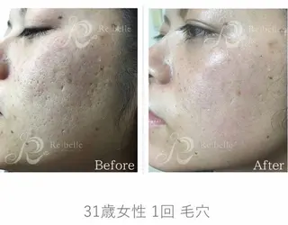 調律エステ /美KISSのその他イメージ