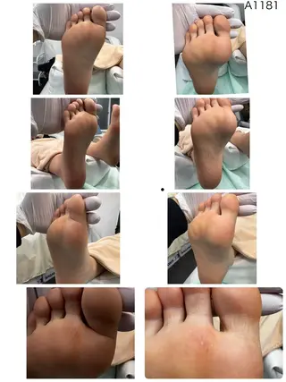 巻き爪補正店枚方店所属・松本 猛史のネイルデザイン