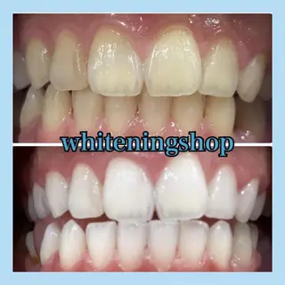 ホワイトニング ショップ千葉店のその他イメージ