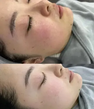 マツエク・マツパ aliaハイフ&水光ジェットサロン所属・aliaハーブ水光店 エステティシャン募集のエステ・リラクイメージ