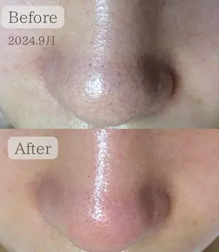 エステサロン Lazulisea所属・川口 春奈のエステ・リラクイメージ