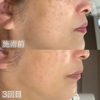 mone~total care salon~所属・mone (モーネ)のマツエク・マツパデザイン