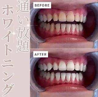 エクシアホワイトニング草津店所属・nanami -ホワイトニングのその他イメージ