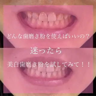 Livicate 💗🧁🎀🦋のマツエク・マツパデザイン