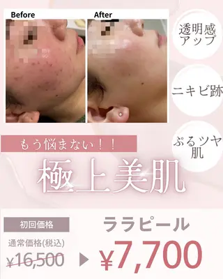 美肌脱毛サロン muroのエステ・リラクイメージ