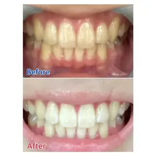 M渋谷店所属・M渋谷 ホワイトニングのエステ・リラクイメージ