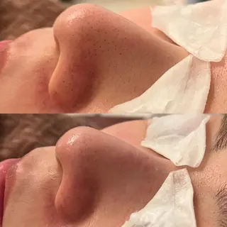 Remina clinical salon所属・ハイフ美肌専門 Remina.c.sのエステ・リラクイメージ