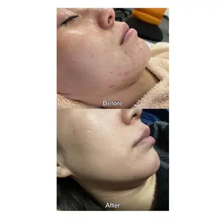 脱毛｜ピーリング ROOM.Sのエステ・リラクイメージ