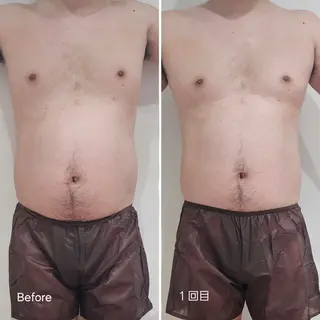 脂肪冷却 & 脱毛 AYUMIのその他イメージ