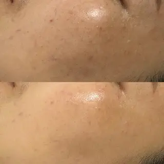 Rifuro毛穴ケア &よもぎ蒸しサロンの眉毛・アイブロウイメージ