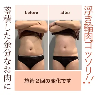 エステサロン JURISのエステ・リラクイメージ