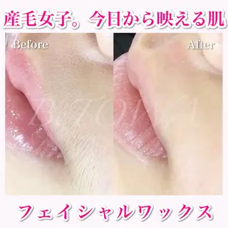BeTOWA所属・BeTOWA 毛穴洗浄/Wax脱毛のエステ・リラクイメージ