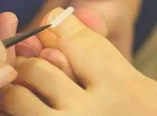 日本巻き爪センター渋谷院所属・日本巻き爪センター 渋谷院のエステ・リラクイメージ