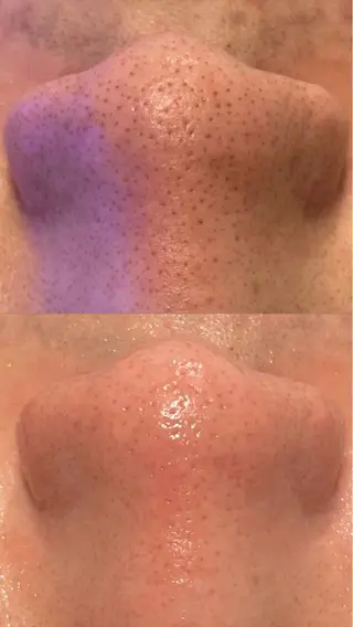 毛穴洗浄専門サロン/CareNa梅田【毛穴/ケアナ】所属・CareNa梅田店 🌿玉田実穂のエステ・リラクイメージ