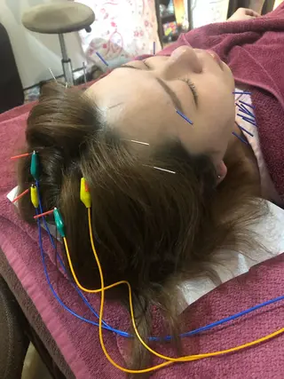 美容鍼灸女性専用 りんご鍼灸治療院のエステ・リラクイメージ