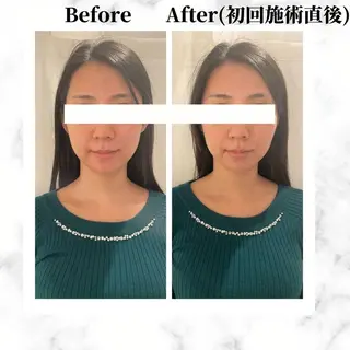 12Dハイフ💗 最強小顔のエステ・リラクイメージ