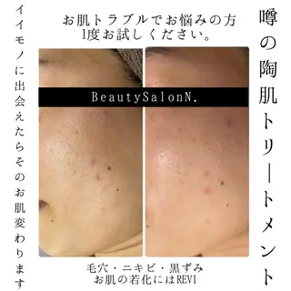 N. 鈴木翔子のエステ・リラクイメージ