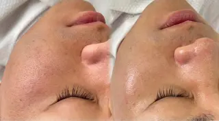 愛維美水光美肌専門店所属・愛維美水光美肌専門店 メンズレディースokのエステ・リラクイメージ